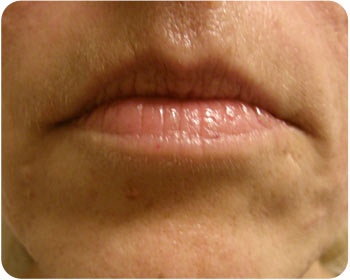 400X300-Elin-pas-lepper-Nov-2011-before