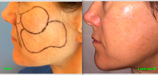 Steinbach pasient image004