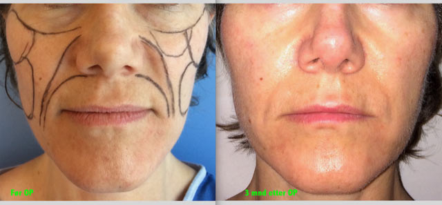 Steinbach pasient image006