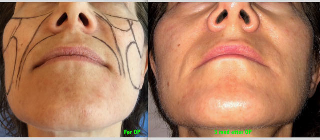 Steinbach pasient image009